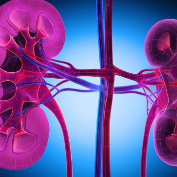 AN AI MODEL TO PREDICT KIDNEY DAMAGE, TRAINED ON DATA FROM VETERANS, WORKS LESS WELL IN WOMEN