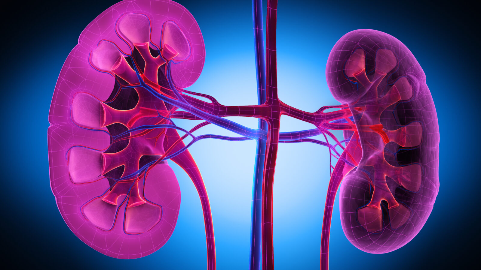 AN AI MODEL TO PREDICT KIDNEY DAMAGE, TRAINED ON DATA FROM VETERANS, WORKS LESS WELL IN WOMEN